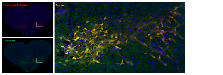 Reveal Dopamine in your samples using our dedicated tools Dopaminergic nigral neurons identified by IS1005 Dopamine antibody that colocalizes with TH staining