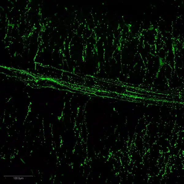 3-MT spinal cord immunostaining of whole-mount mouse embryos