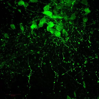 Whole mount hindbrain immunostaining of 3MT containing cells.