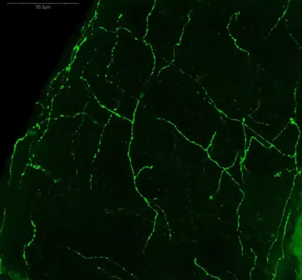 3-MT immunostaining of adult mouse cerebellum