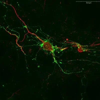 Anti-Serotonin antibody: Staining of serotoninergic neurons in mouse primary hindbrain culture