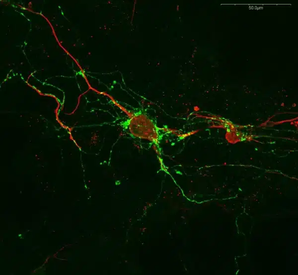 Anti-Serotonin antibody: Staining of serotoninergic neurons in mouse primary hindbrain culture