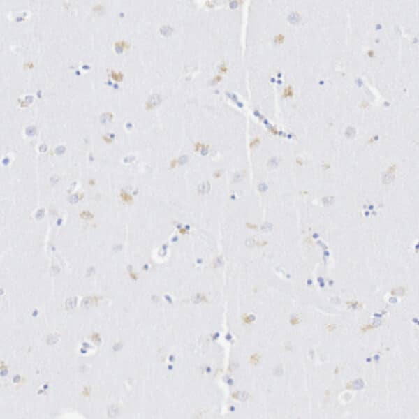 Cinnabarinic acid detection by IHC in human caudate putamen