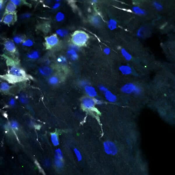 Dopamine (green), TH (white), Hoechst (blue) in 30-day brain organoid (hiPSC)