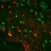 GABA antibody and Dopamine immunostaining in crayfish eyetalk