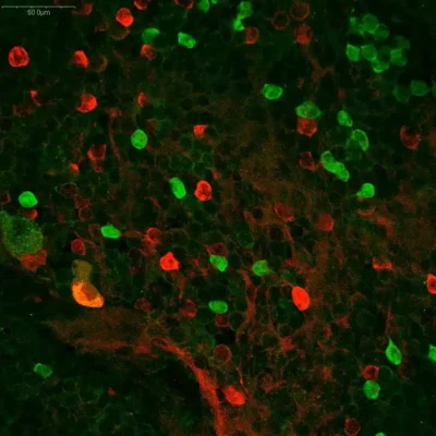 GABA antibody and Dopamine immunostaining in crayfish eyetalk