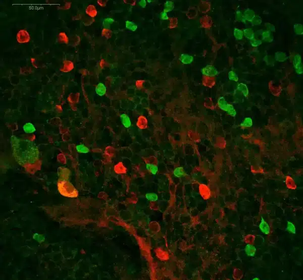 GABA antibody and Dopamine immunostaining in crayfish eyetalk
