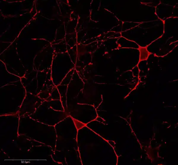 GABA immunostaining in mouse cortical primary neurons
