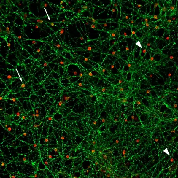 GABAergic network and glutamatergic cell populations in a mature rat cortical culture