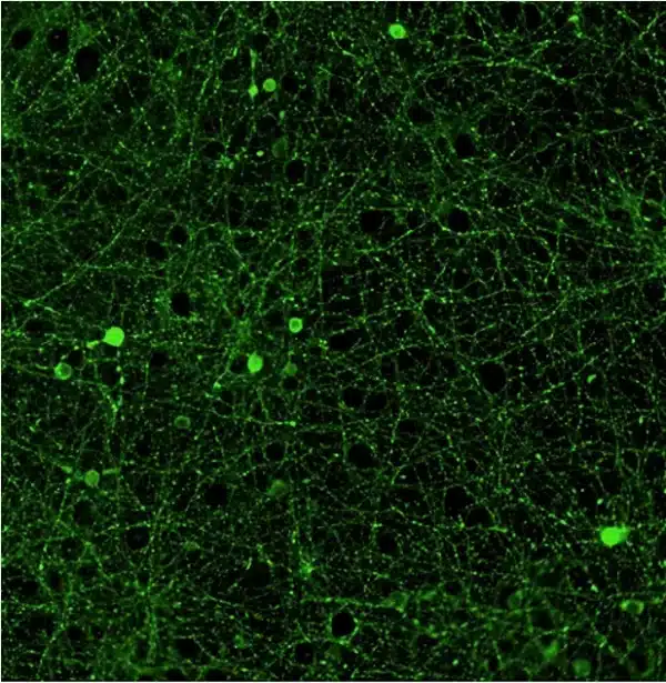 GABAergic neuronal network