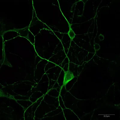 Glycine detection in primary mouse cortical neurons