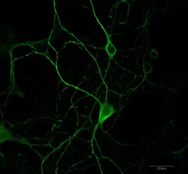 Glycine detection in primary mouse cortical neurons