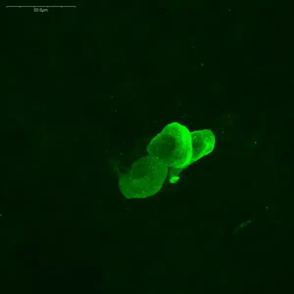 Histamine antibody - histamine detection into crayfish CNS