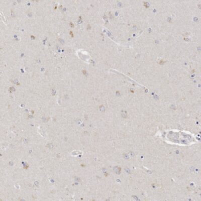 IHC validation of 3-HydroxyAnthranilic acid antibody in human brain tissue