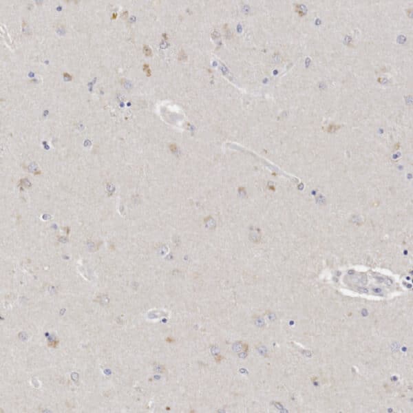 IHC validation of 3-HydroxyAnthranilic acid antibody in human brain tissue