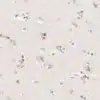 Xanthurenic acid detection by IHC in human midbrain