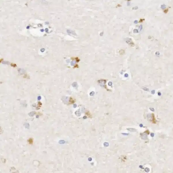 Xanthurenic acid detection by IHC in human midbrain