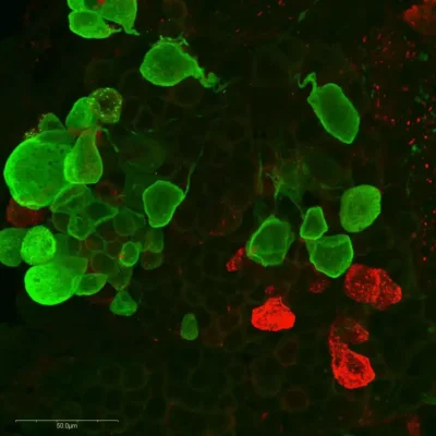 Immunolabeling of Octopaminergic and Serotoninergic neurons