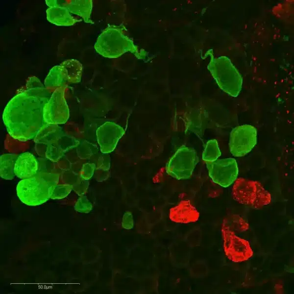 Immunolabeling of Octopaminergic and Serotoninergic neurons