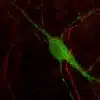 Immunostaining of Dopamine and Serotonin in mouse culture of primary midbrain neurons