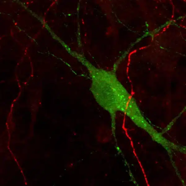Immunostaining of Dopamine and Serotonin in mouse culture of primary midbrain neurons