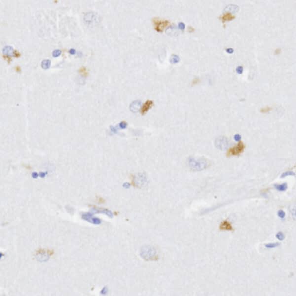 L-Kynurenine detection in human brain tissue by IHC