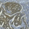 L-Kynurenine detection in human colon cancer tissue by IHC