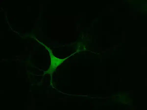 Phenyl-L.Alanine imaging in mouse embryonic midbrain neurons (E13.5)