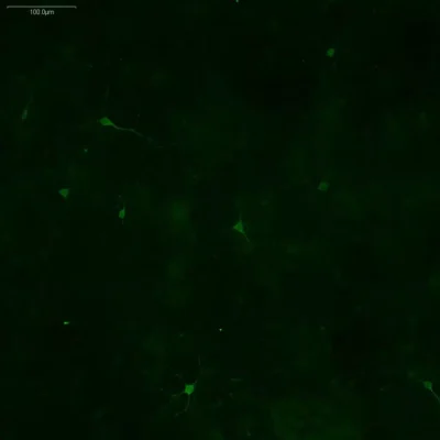 L-Tyrosine antibody imaging in mouse embryonic midbrain neurons