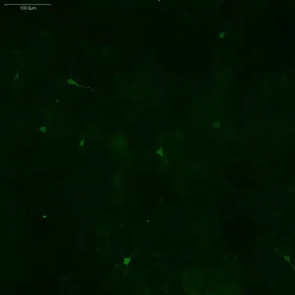 L-Tyrosine antibody imaging in mouse embryonic midbrain neurons