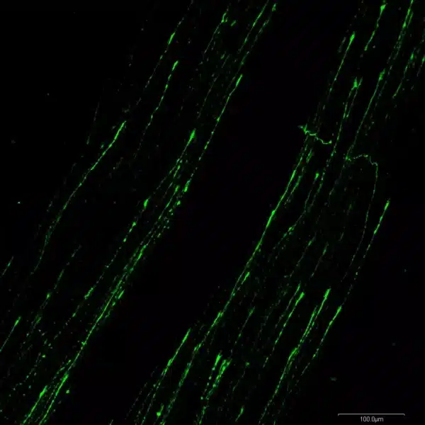 Norepinephrine fibers in the spinal cord of embryonic mouse.