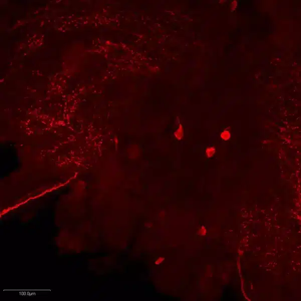 Serotonin antibody Serotoninergic neurons in crayfish brain