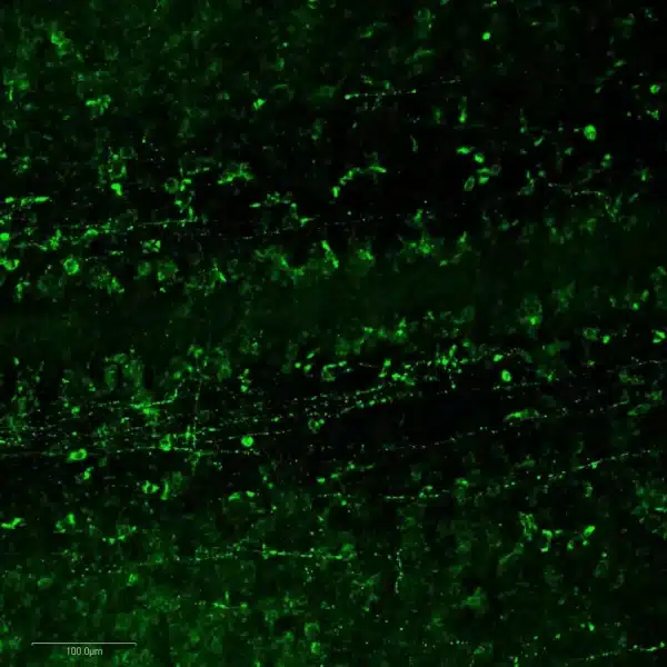 Serotonin neurons and fibers in embryonic mouse medulla