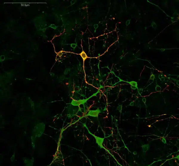 Staining of L-Serine and GABA positive neurons in mouse primary cortical culture