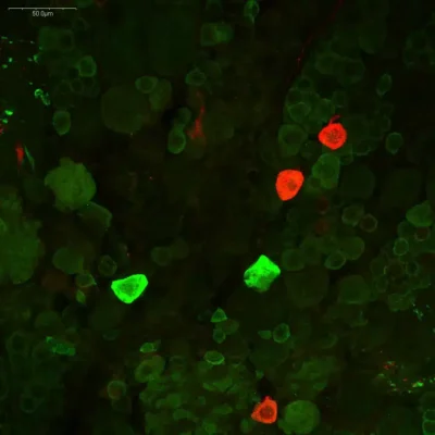 Dopaminergic and serotoninergic neurons in crayfish brain