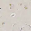 Kynurenic acid detection in human brain by IHC