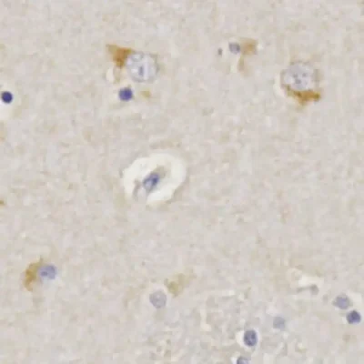 Kynurenic acid detection in human brain by IHC