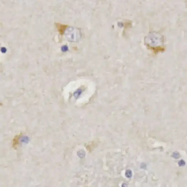 Kynurenic acid detection in human brain by IHC