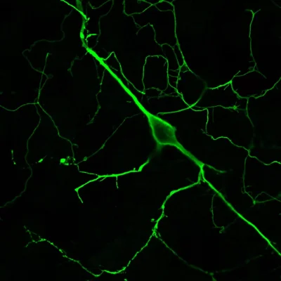 Imaging of L-DOPA neurons in mouse primary neurons