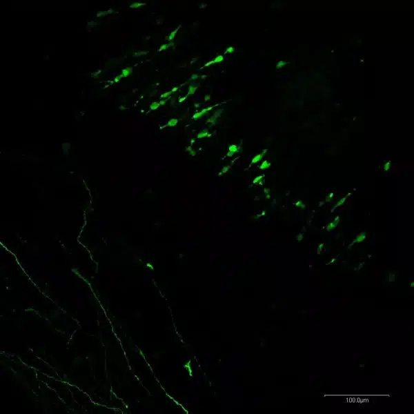Noradrenergic neurons in the pons of embryonic mouse.