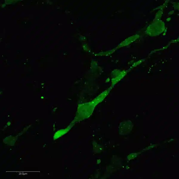 Noradrenergic neurons in CNS of mouse embryo.