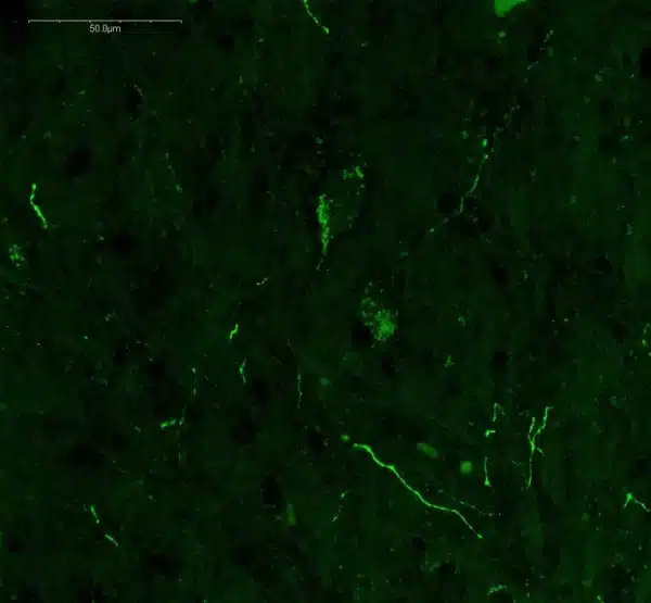 Detection of Normetanephrine in adult mouse midbrain