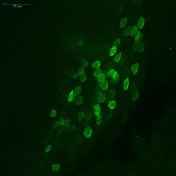 Imaging of Octopamine in brain of a crayfish
