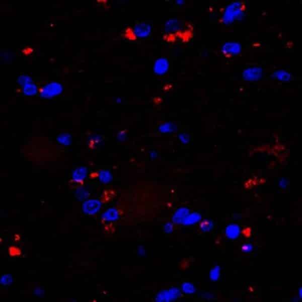 Quinaldic acid detection by IF in human brain