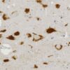 Quinolinic acid detection in human midbrain by immunohistochemistry (IHC)