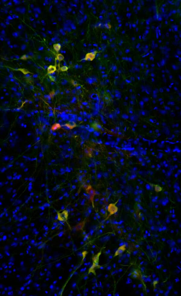 Dopaminergic neurons of the Substantia Nigra pars compacta (SNc) in coronal rat brain sections
