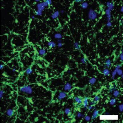 glutamine antibody human midbrain-organoids