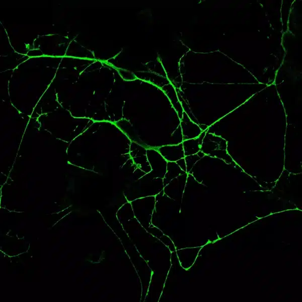 Glycine detection in primary mouse cortical neurons - fibers and soma