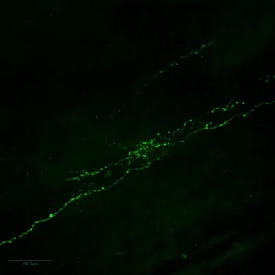 Immunofluorescence imaging of Normetanephrine in crayfish