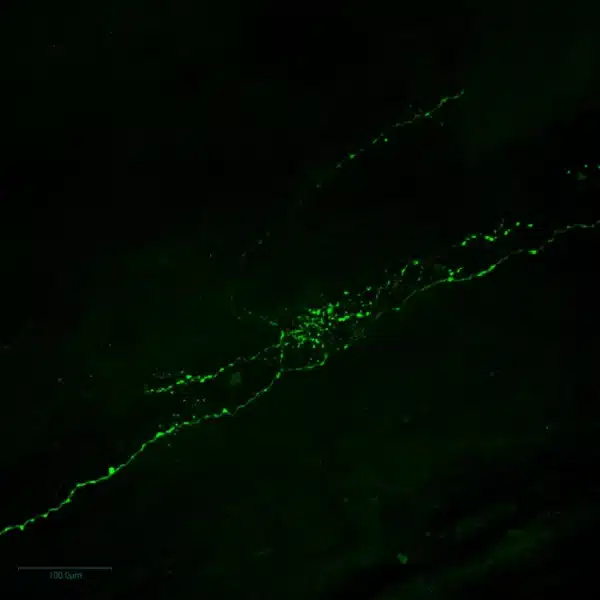 Immunofluorescence imaging of Normetanephrine in crayfish
